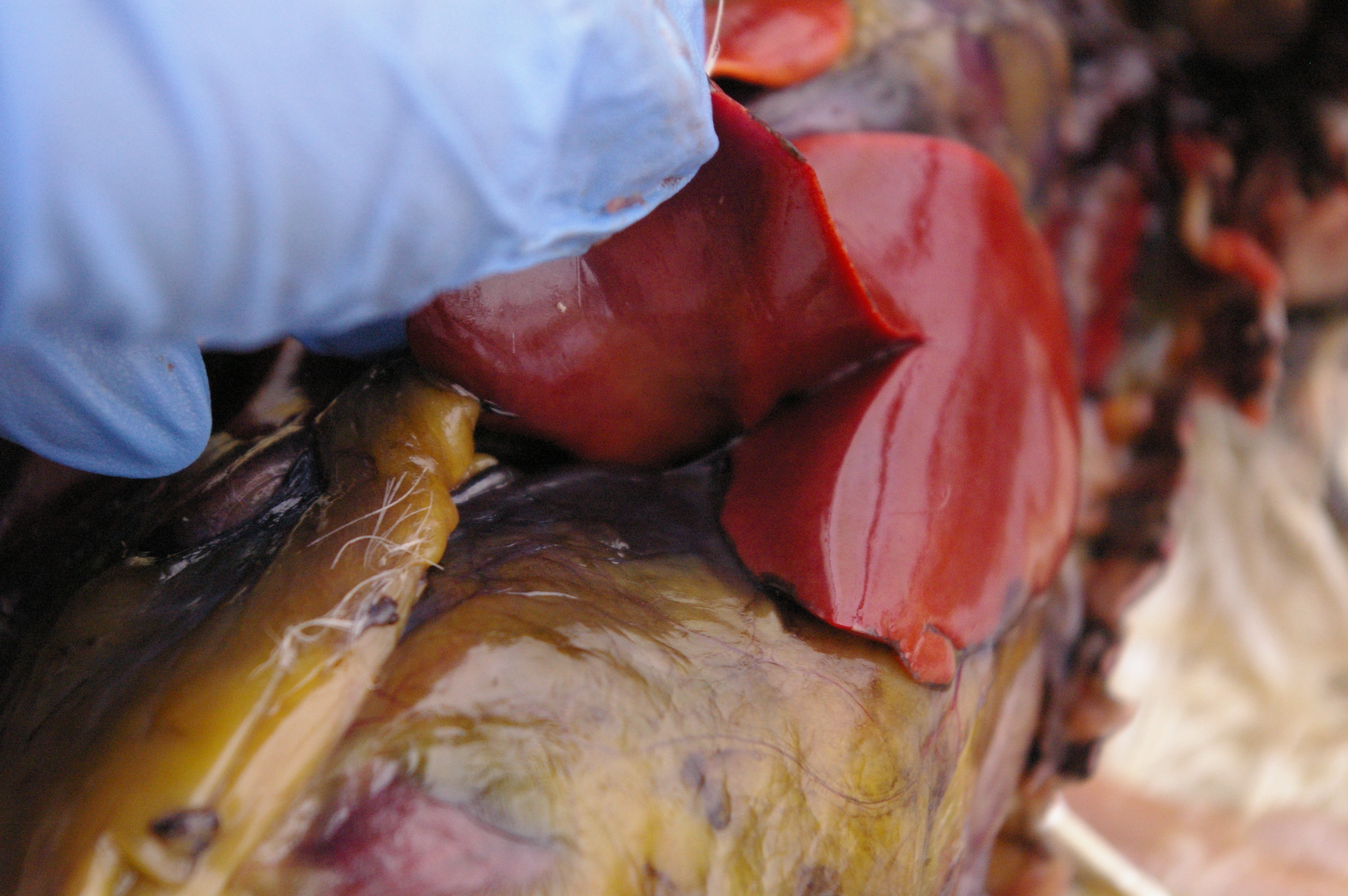 Liver has lobes