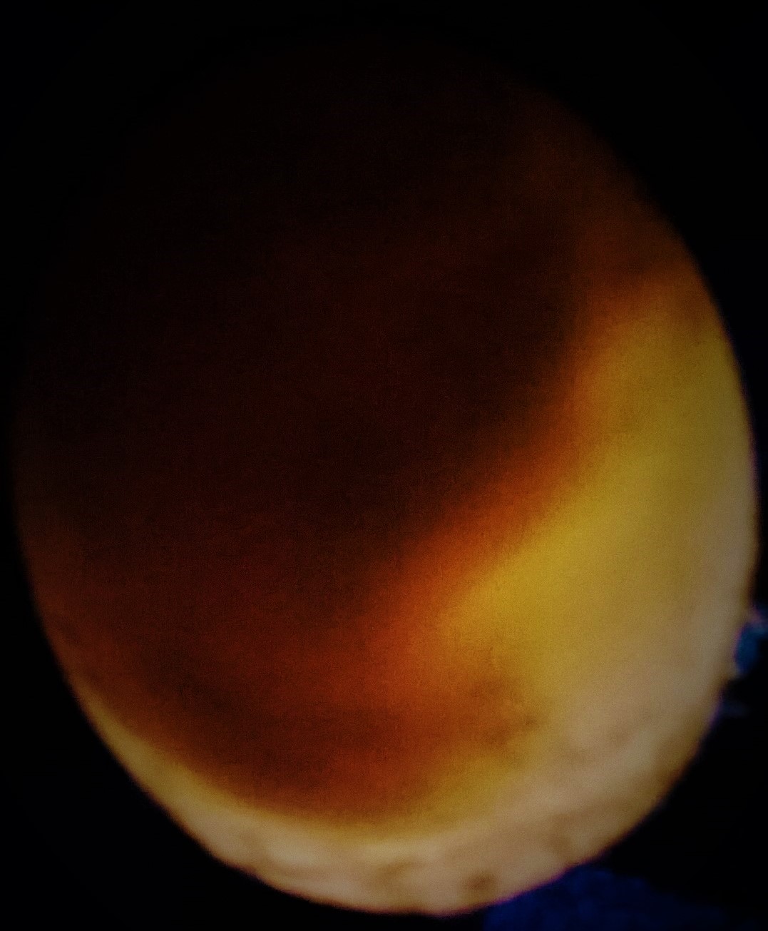 March 31 candling. Any comments would be greatly appreciated. I tried to Photoshop pics so they would be a little clearer. Obviously something is going on in there. We just aren't sure what. This is our first attempt to hatch.