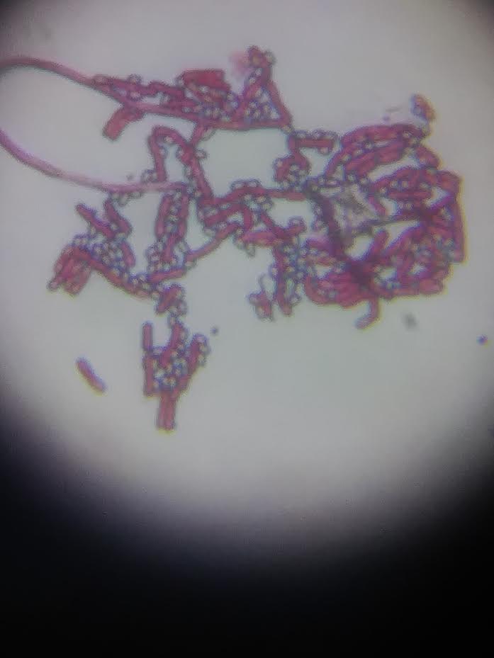 Moraxella on Gram stain