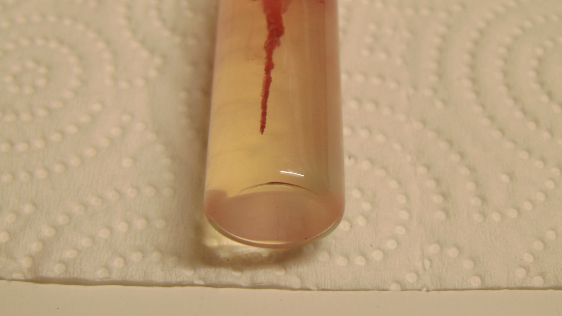 Non-Motile Bacteria in Motility agar. | BackYard Chickens - Learn How