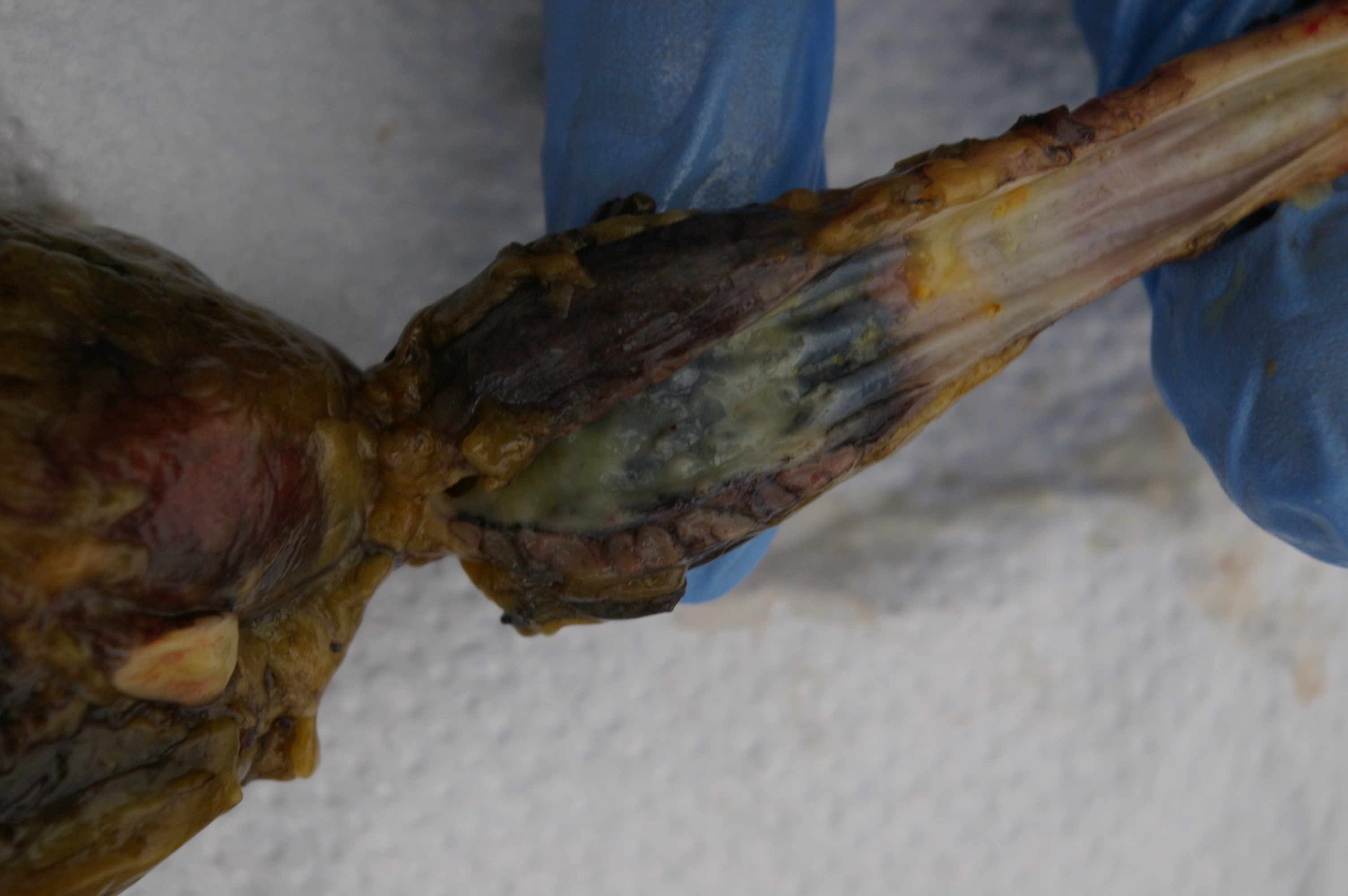 Proventricular. This secretes digestive juices and adds it to the food before it enters the gizzard