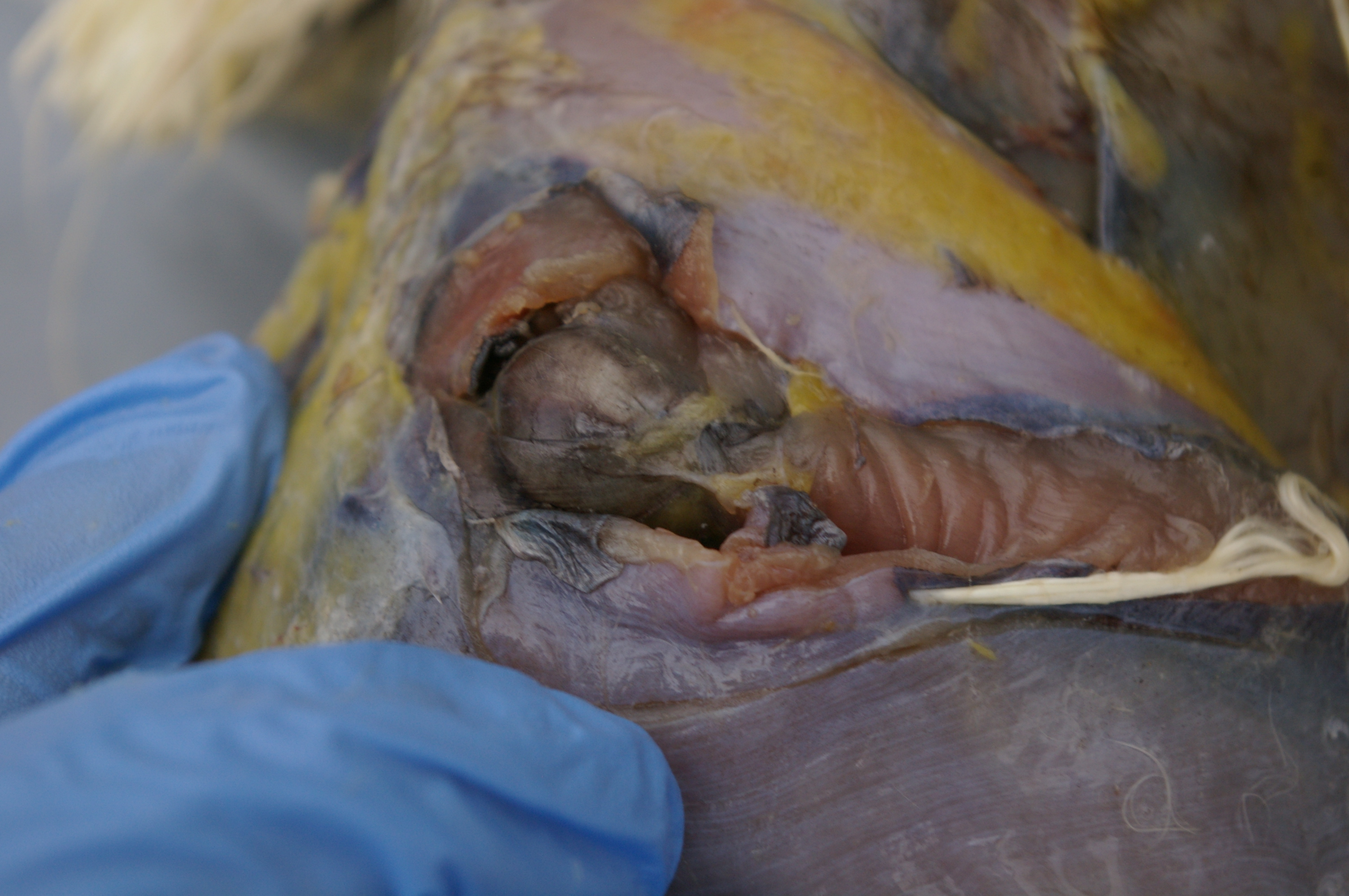 Right hip joint.