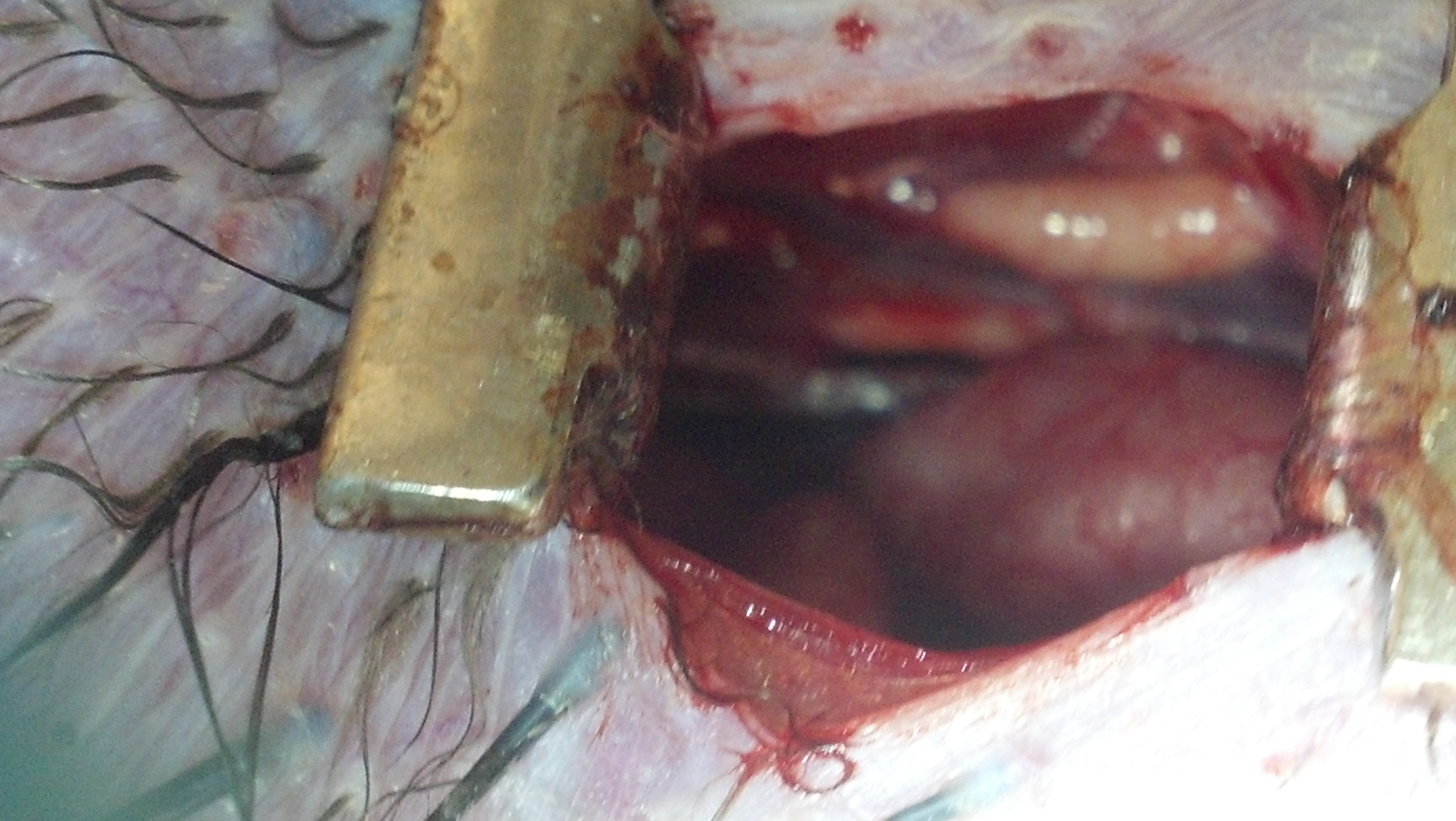 Right sided approach....what you hope to see when the abdominal cavity is opened....BOTH testes....beware of all of those blood vessels between them and below them.