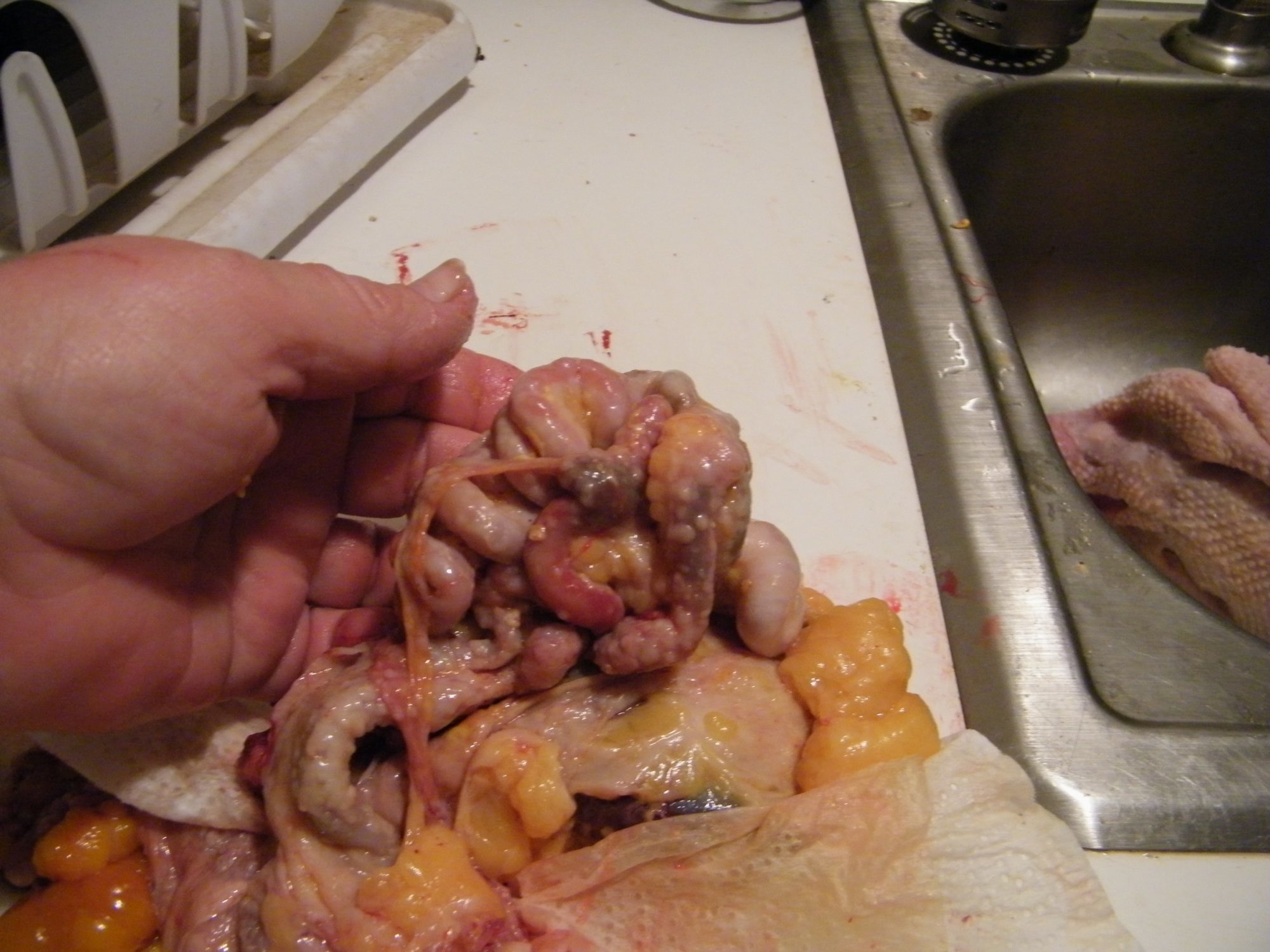 See how tightly wound the intestines are.  They are hard instead of soft like a healthy intestine. Not at all flexible.  Notice too, the little dots or lesions or whatever they're called... absolutely everywhere.