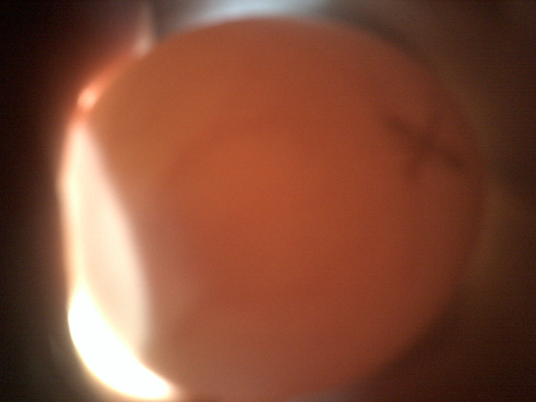 Shipped duck#6 acward veining or blood ring?