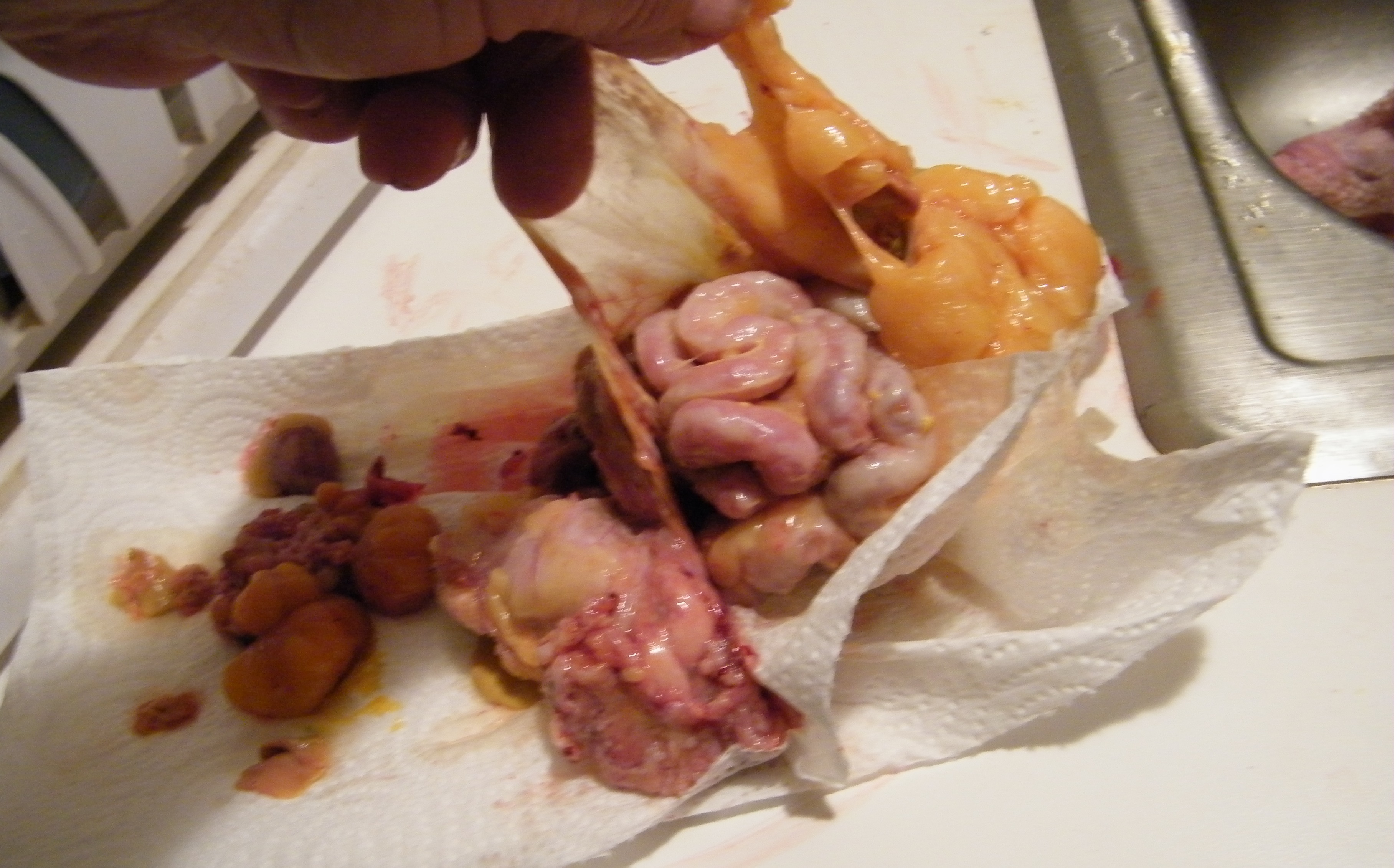 Some kind of sac around the intestines.