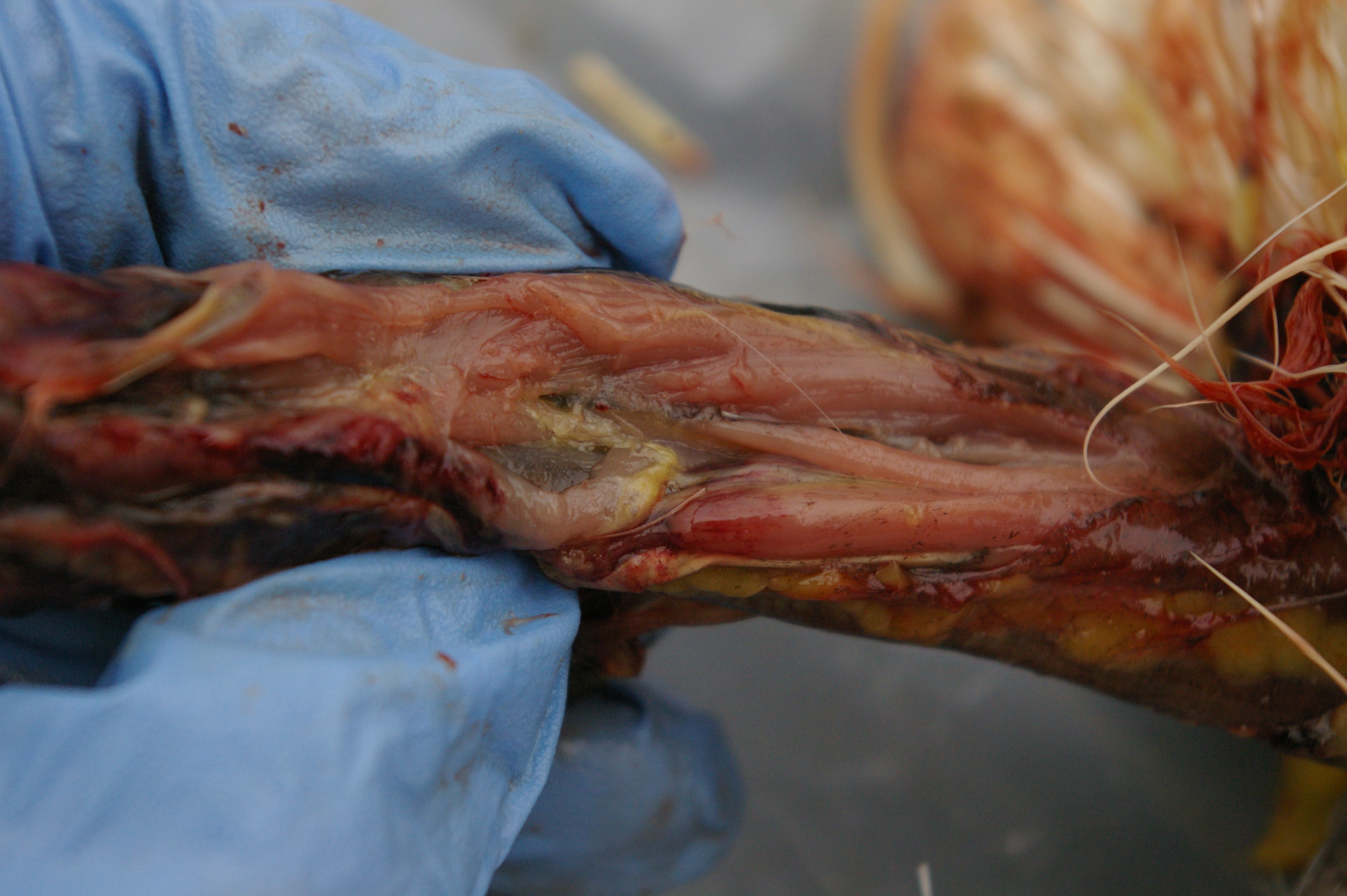 Some of the neck muscles