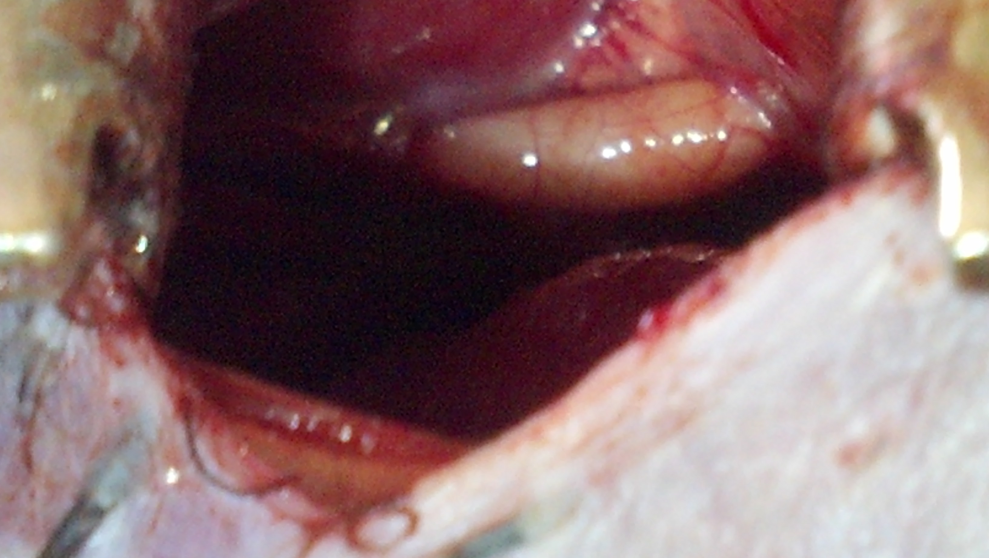 The lower..left...testicle removed and the right one remaining.