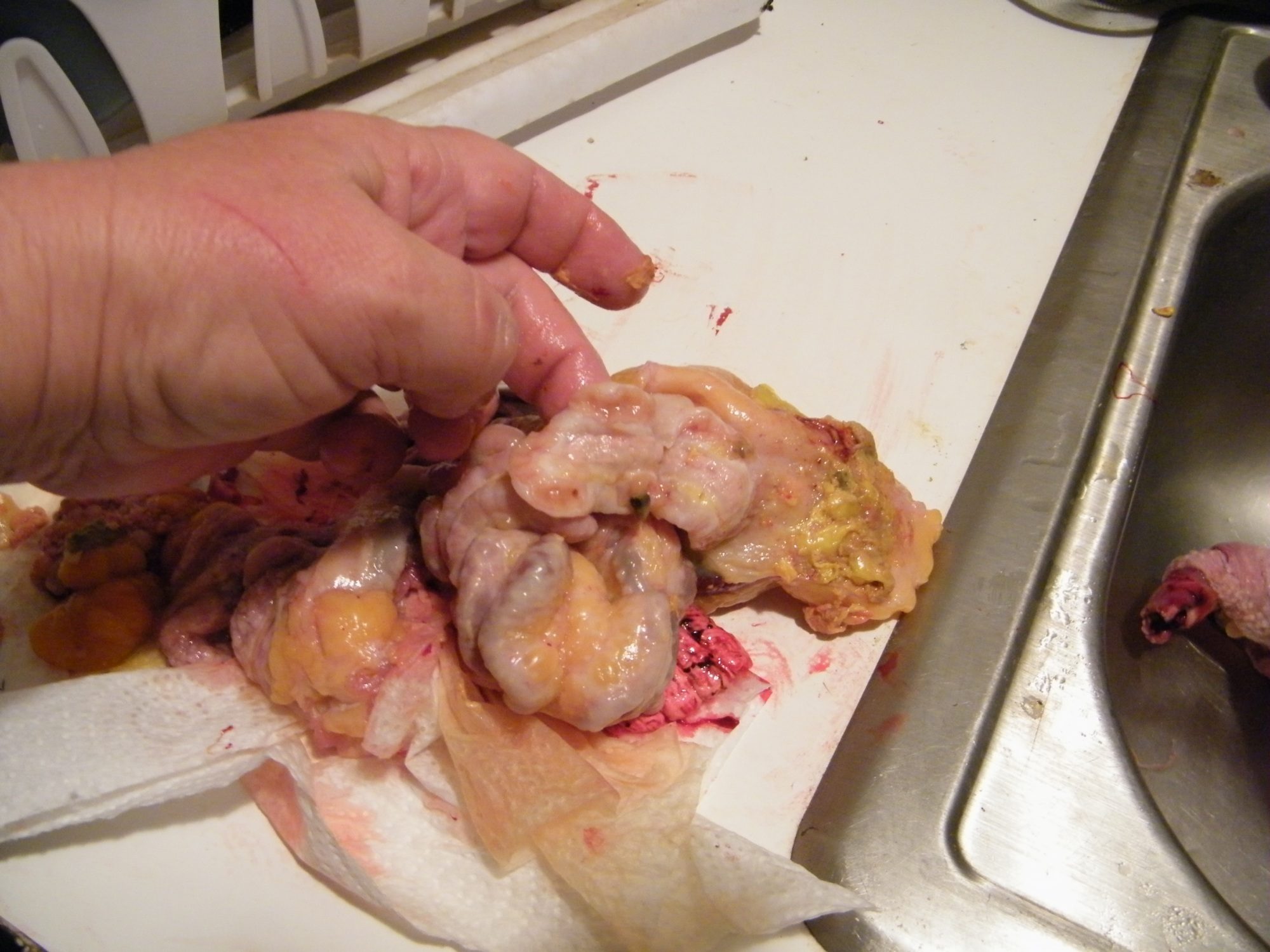 This is the duodenum sliced open across both sides at once.  Can't really tell much from the photos but it was pretty much a solid mass.