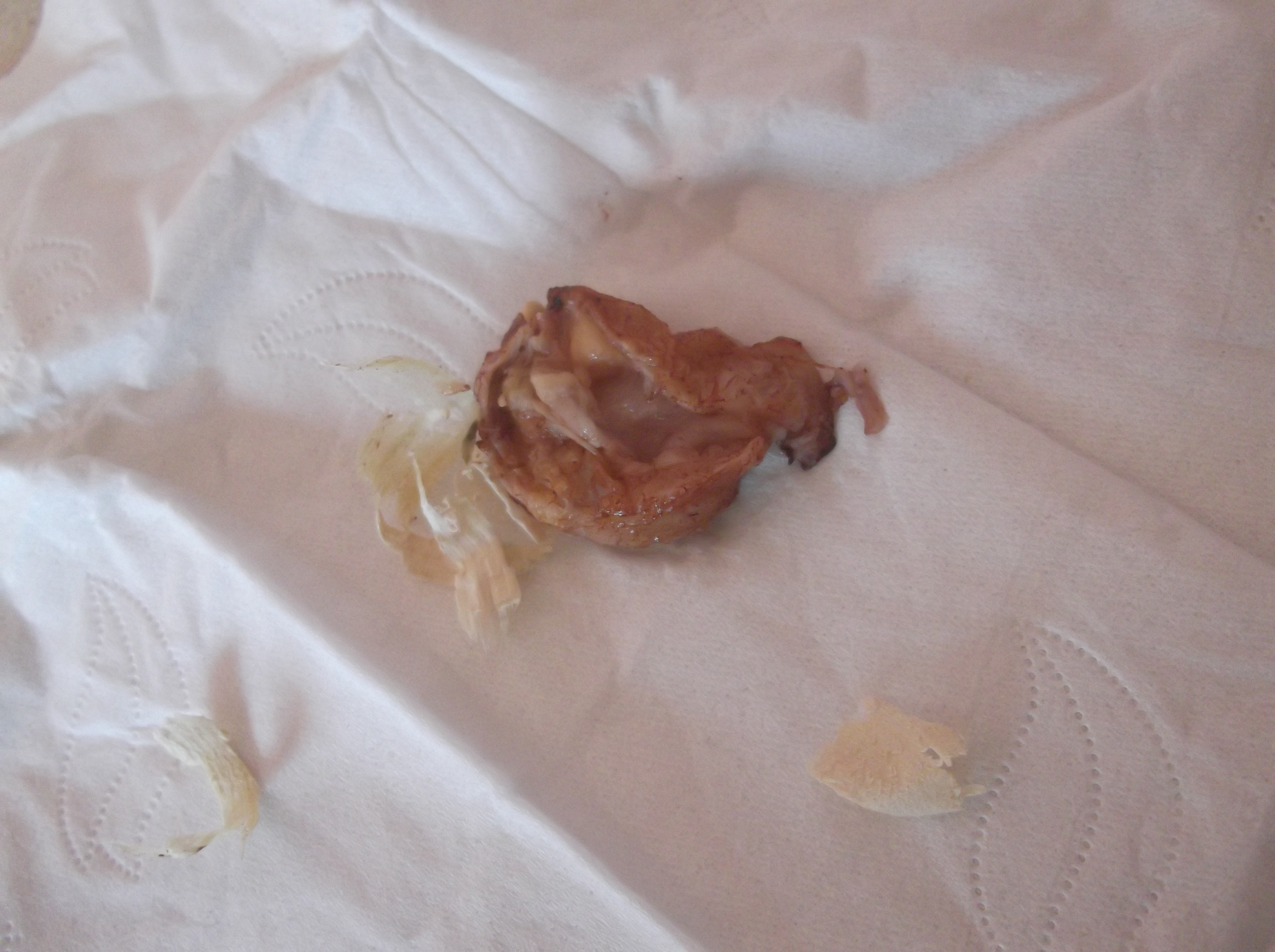 This is the lump I found