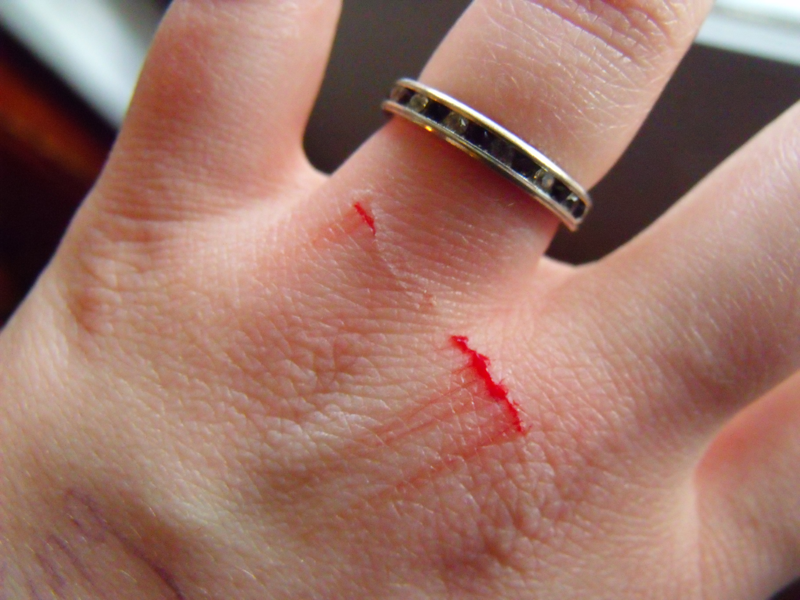 This is what happens when I try to put a bird in a cage for extra special care >.< and the chicken didnt even cause it the stupid wire did XD
