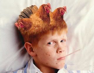 chickenpox.jpg