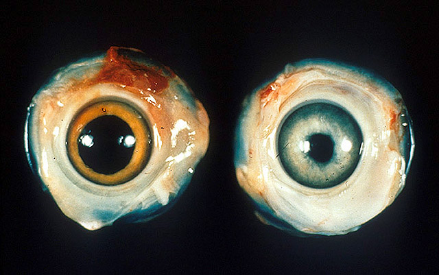 Ocular_Marek%27s_disease.jpg
