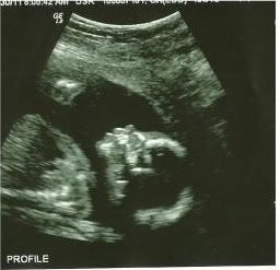 baby2.jpg