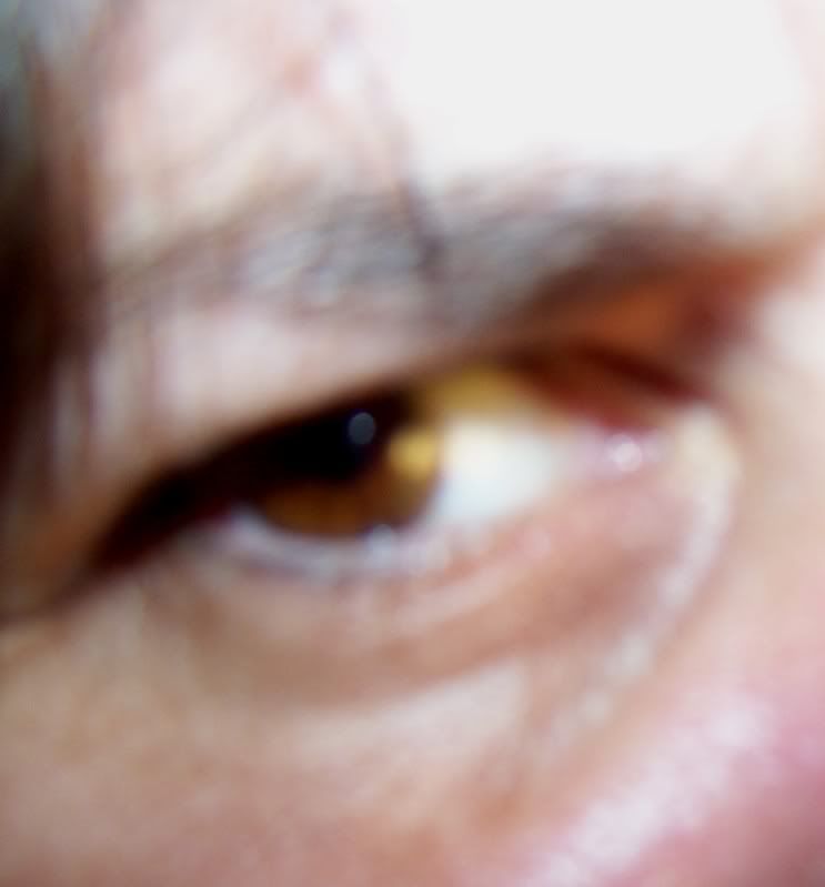 stinkeye1.jpg