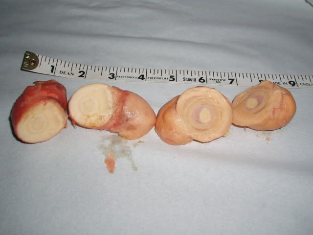 GTumour13209008.jpg