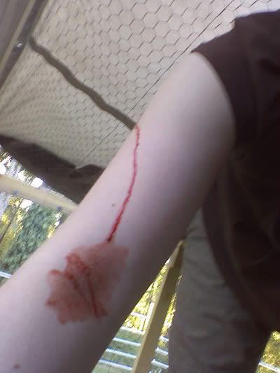 bleeding2.jpg