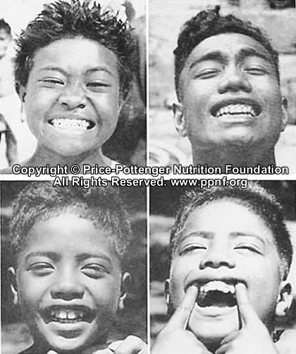 children_disease_samoan.jpg