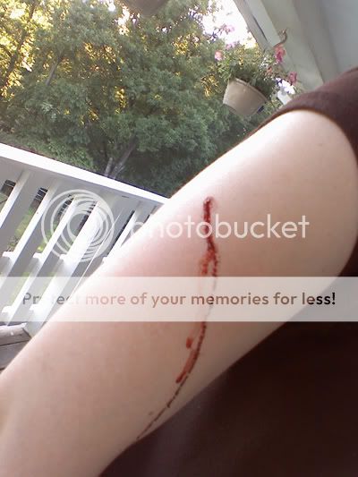 bleeding1.jpg