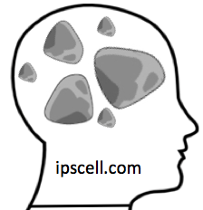 Rocks-in-Your-Head.png